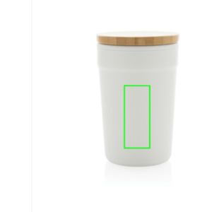 Parte frontal del artículo